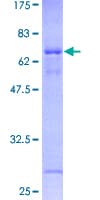 Human OVCA1 / DPH1 Protein (Recombinant GST)