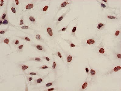 Polyclonal Rabbit anti-Human HIST1H4I Antibody (IHC, IF)