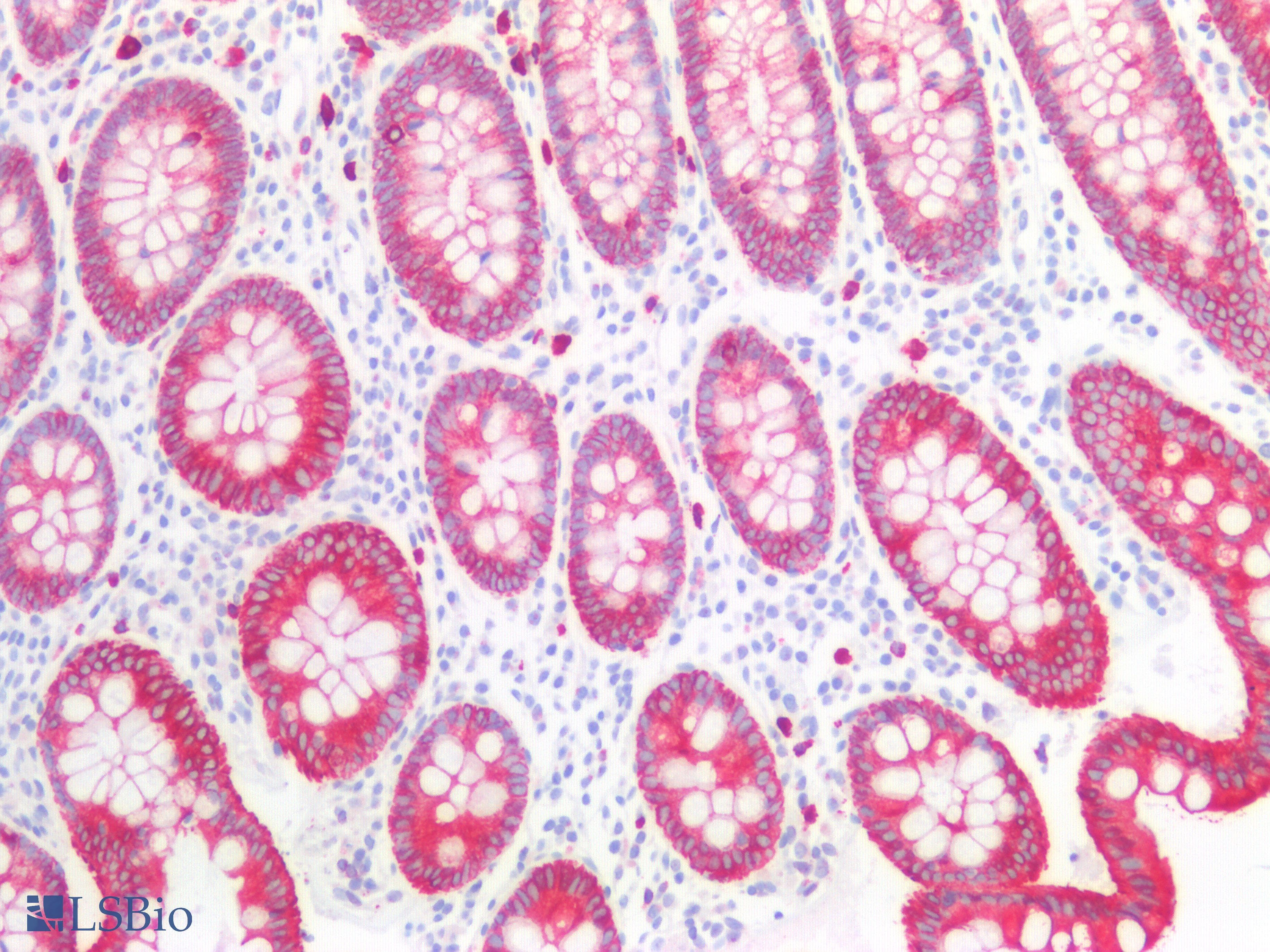 PathPlus™ Polyclonal Rabbit anti-Human KRT8 / CK8 / Cytokeratin 8 Antibody (C-Terminus, IHC, IF, WB)