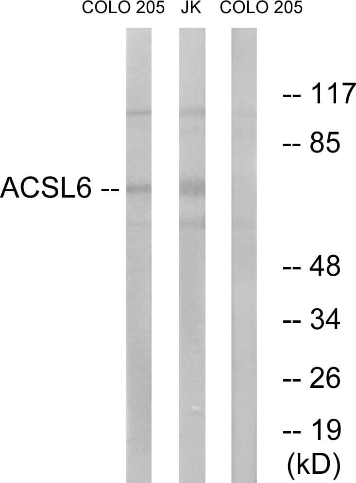 IHC-plus™ Polyclonal Rabbit anti-Human ACSL6 Antibody (aa499-548, IHC, WB)