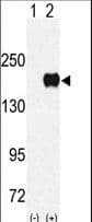 Polyclonal Rabbit anti-Human EHMT1 Antibody (aa195-226, WB)