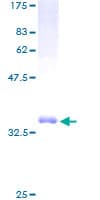 Human TCTA Protein (Recombinant GST)