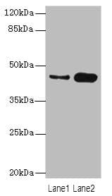 Polyclonal Rabbit anti-Human CSNK1G2 / CKI-Gamma 2 Antibody (IHC, WB)