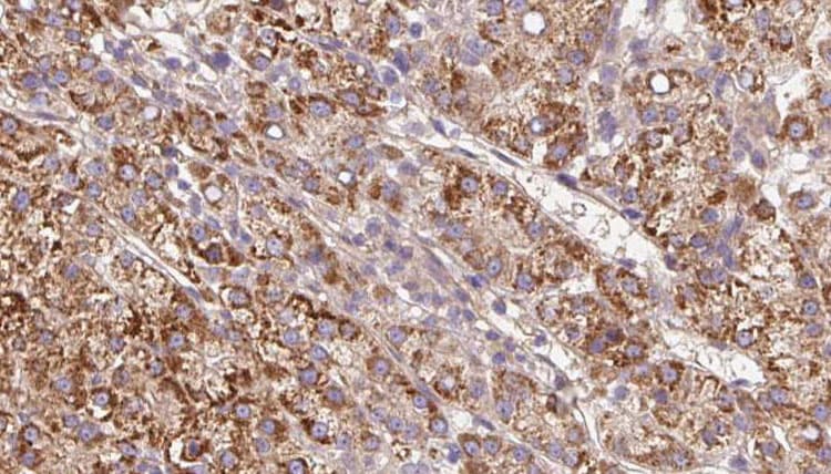 CHRNB4 Antibody