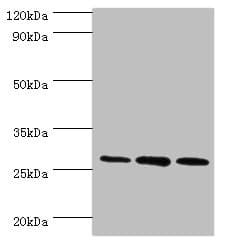 Polyclonal Rabbit anti-Human ORC6 / ORC6L Antibody (aa1-252, IHC, WB)