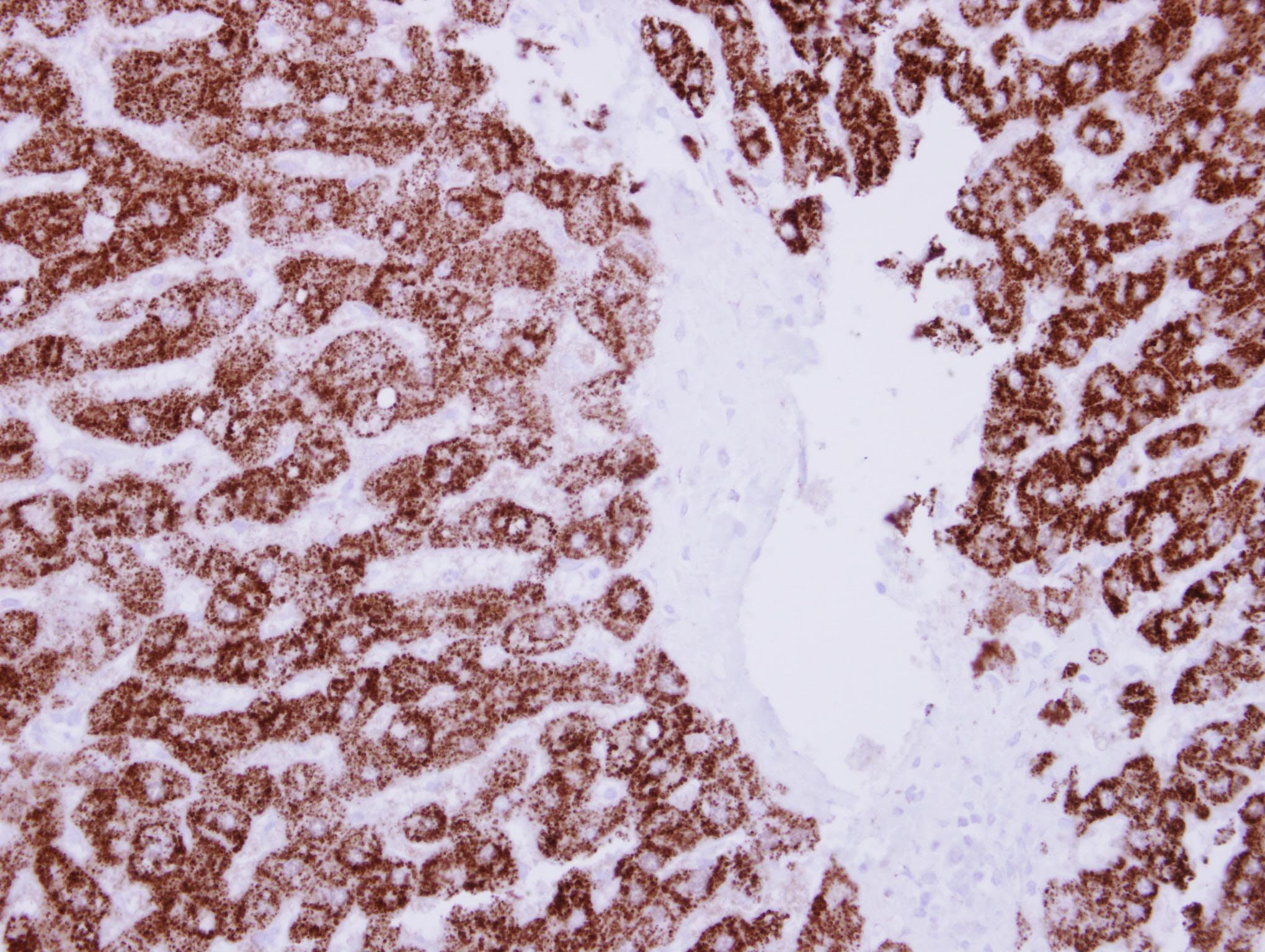 Polyclonal Rabbit anti-Human ALDH6A1 Antibody (IHC, WB)
