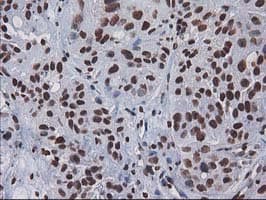 CTDSP1 / SCP1 Antibody (clone OTI1B6)