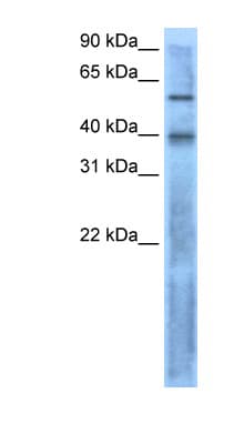 Polyclonal Rabbit anti-Human TGFB4 / LEFTY2 Antibody (N-Terminus, IHC, WB)