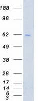 Human PLK1 / PLK-1 Protein (Recombinant Myc-DDK (Flag))