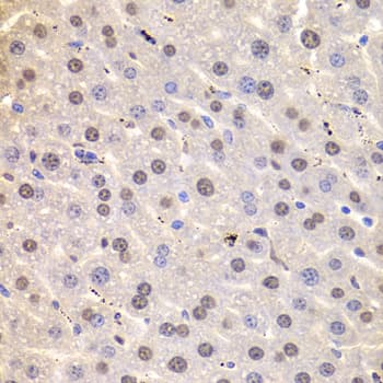 Polyclonal Rabbit anti-Human HNRNPD / AUF1 Antibody (IHC, WB)