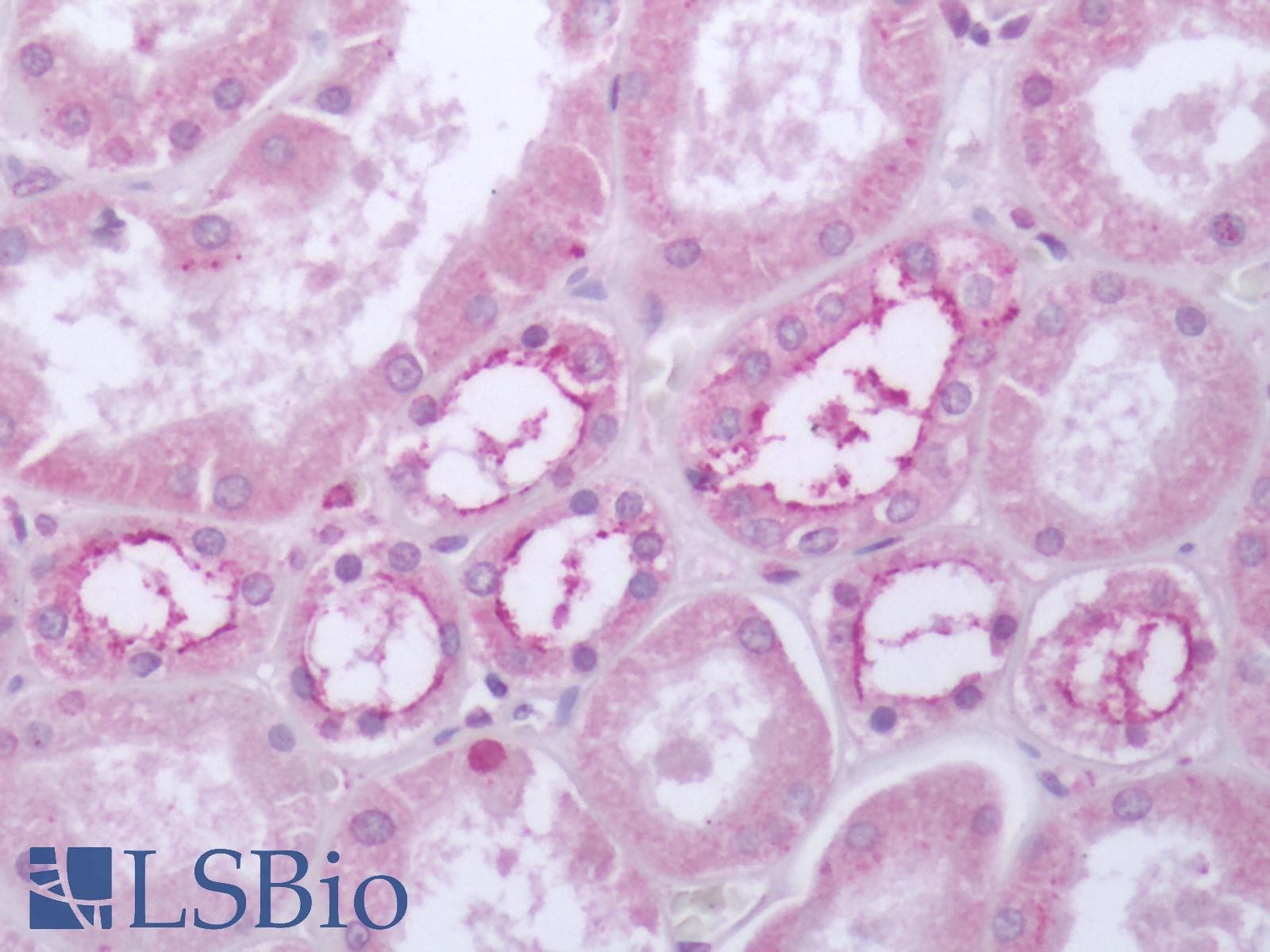 PathPlus™ Polyclonal Rabbit anti-Human HTR4 / 5-HT4 Receptor Antibody (Cytoplasmic Domain, IHC)
