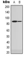 SCNN1G / ENaC Gamma Antibody (Internal)