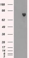 BTK Antibody (clone OTI6H9)