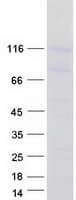 Human PCDHGA6 Protein (Recombinant Myc-DDK (Flag))