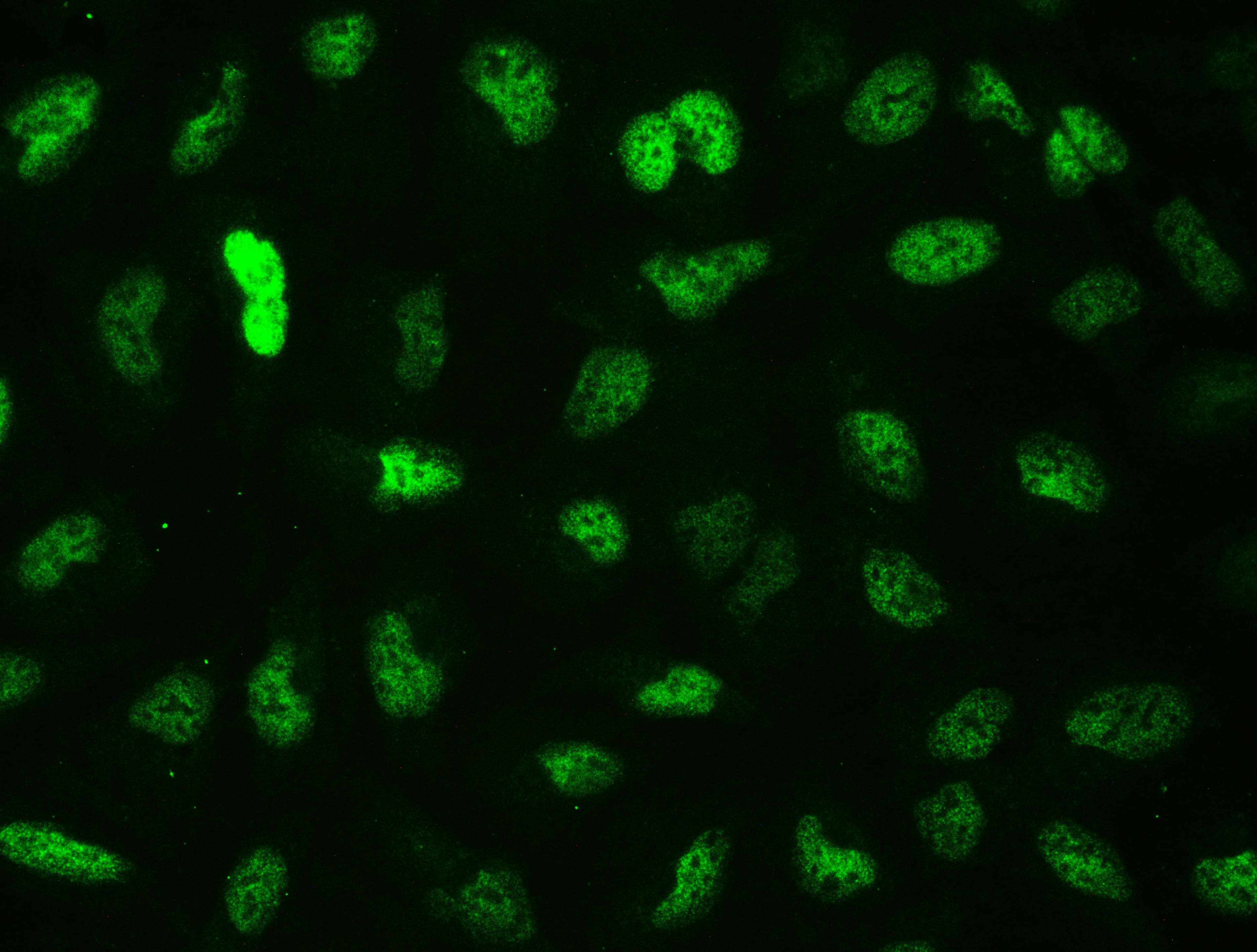 CTBP2 Antibody (aa321-445)