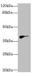 HDS / DHDDS Antibody