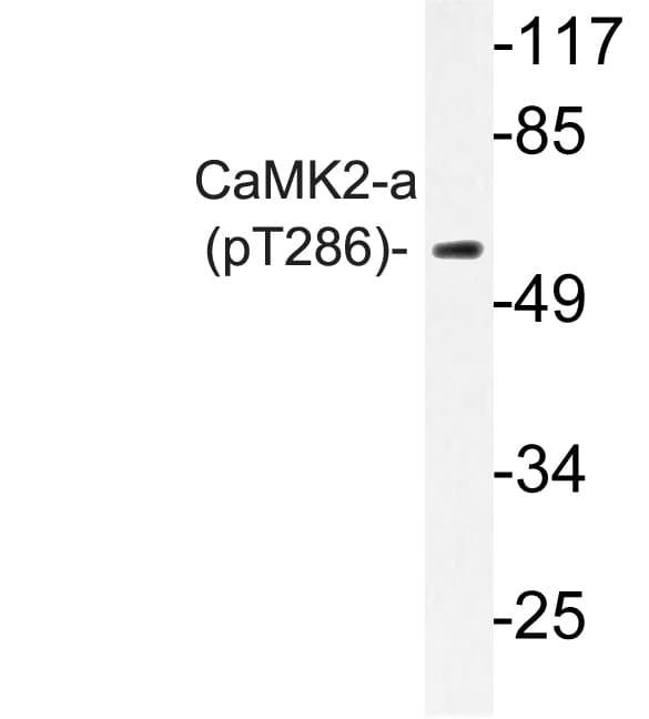 Polyclonal Rabbit anti-Human CAMK2A / CaMKII Alpha Antibody (phospho-Thr286, IHC, WB)
