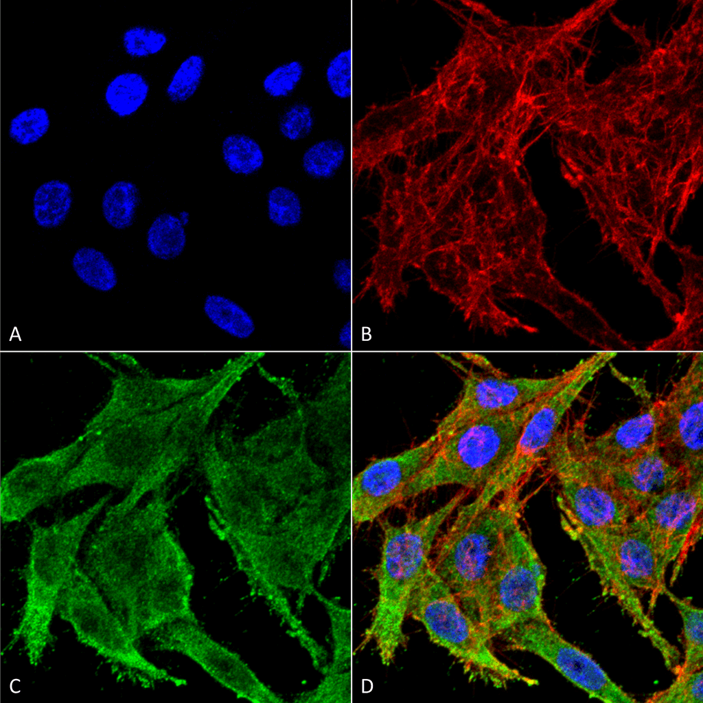 Polyclonal Rabbit anti-Human KCNJ10 / SESAME / KIR4.1 Antibody (PerCP, IHC, IF, WB)