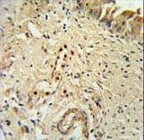 Polyclonal Rabbit anti-Human ID4 Antibody (aa1-30, IHC, WB)
