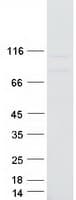 Human MOV10 Protein (Recombinant Myc-DDK (Flag))