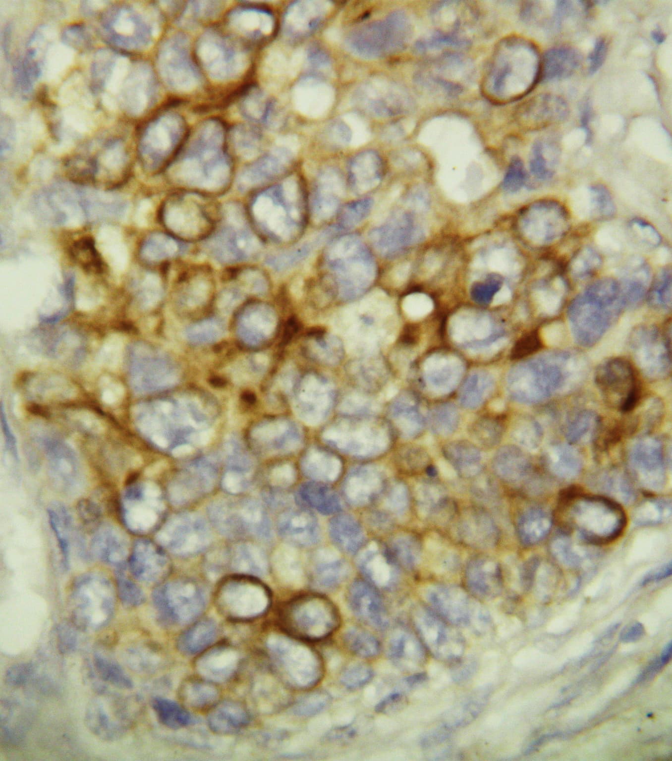 Polyclonal Rabbit anti-Human CASP6 / Caspase 6 Antibody (aa24-44, IHC, WB)