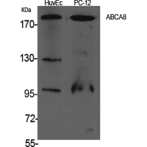 Polyclonal Rabbit anti-Human ABCA8 Antibody (1120-1200 aa, Internal, WB)