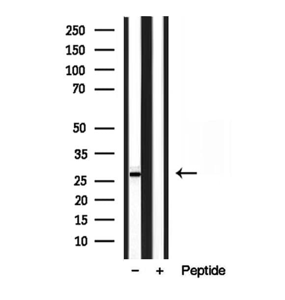 TPI1 / TPI Antibody