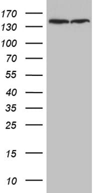 Monoclonal Mouse anti-Human SMC1A / SMC1 Antibody (clone OTI3G4, aa889-1016, IHC, WB)