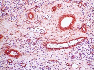 Collagen IV Antibody (clone C IV 22)