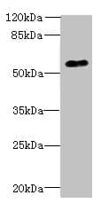 Polyclonal Rabbit anti-Human GPR176 Antibody (WB)
