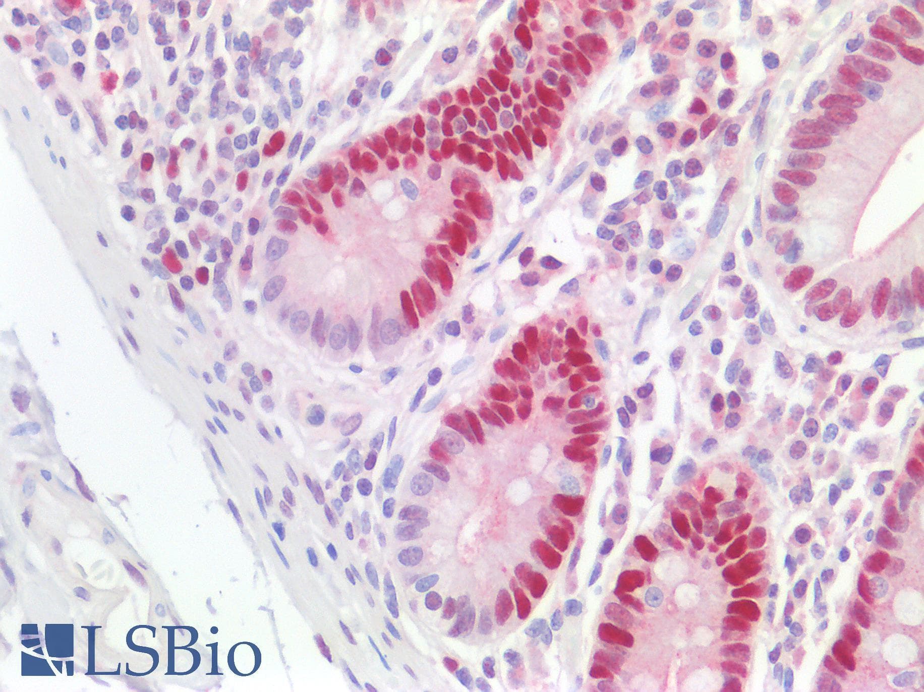 PathPlus™ PCNA Antibody