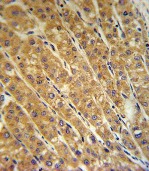 CP / Ceruloplasmin Antibody (aa547-577)