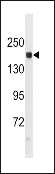 Hamartin / TSC1 Antibody (aa1117-1144)