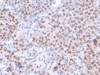 POLR2A / RNA polymerase II Antibody (clone CTD 8A7)