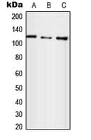 IHC-plus™ Polyclonal Rabbit anti-Human E4 / UBE4A Antibody (N-Terminus, IHC, WB)