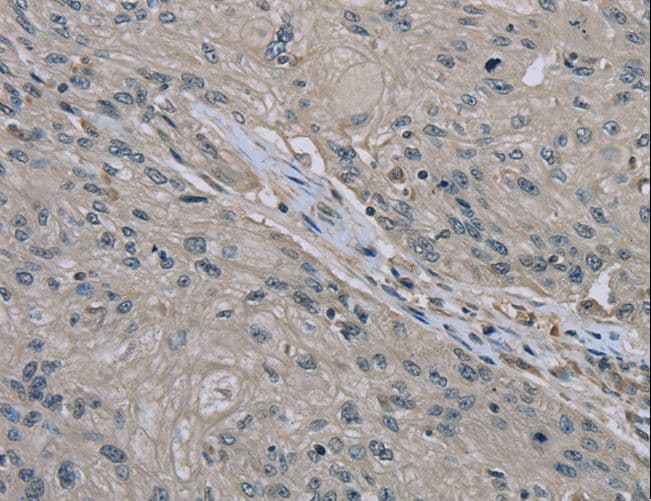 EDN1 / Endothelin 1 Antibody