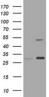 KRT20 / CK20 / Cytokeratin 20 Antibody (clone OTI3A5)