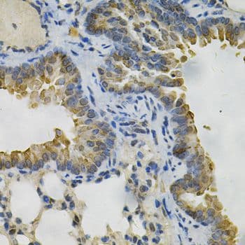 AKR1B1 / Aldose Reductase Antibody