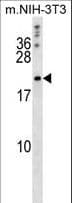 Polyclonal Rabbit anti-Human BCL2L2 / Bcl-w Antibody (aa24-59, IHC, WB)