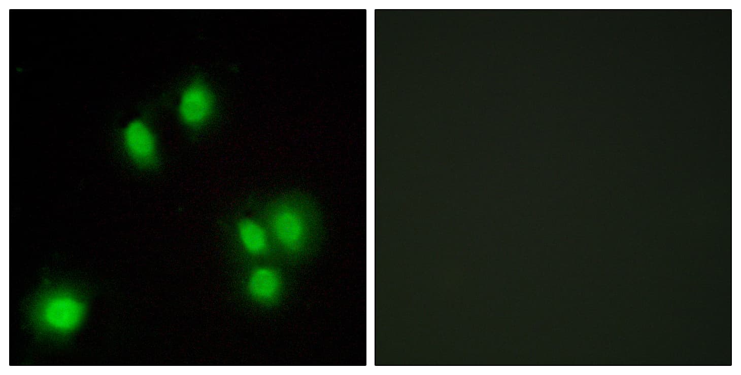 Polyclonal Rabbit anti-Human CR6 / GADD45G Antibody (aa101-150, IHC, IF)