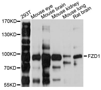 FZD1 / Frizzled 1 Antibody