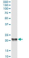 Monoclonal Mouse anti-Human PEBP1 / RKIP Antibody (clone 2G2-1F1, WB)