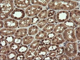 TRMT2A Antibody (clone OTI1C3)
