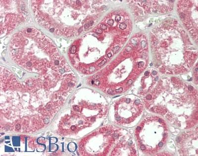 IHC-plus™ Monoclonal Mouse anti-Human IL20 Antibody (clone 2B1, aa25-176, IHC, WB)