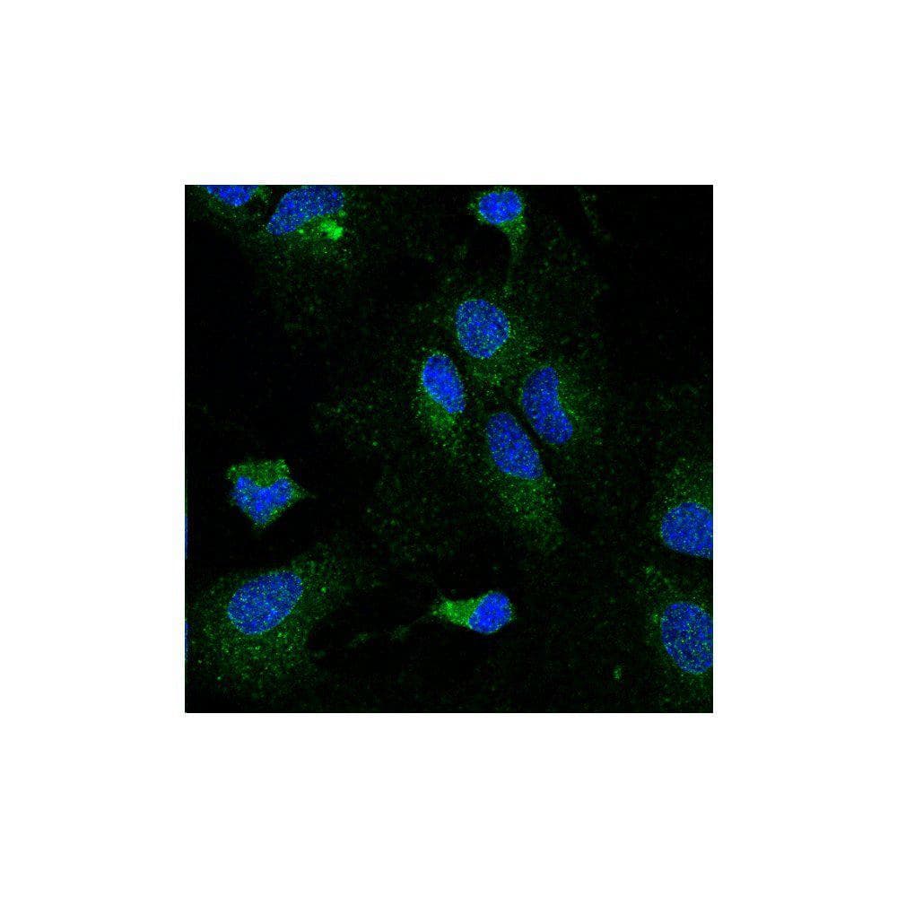 LPL / Lipoprotein Lipase Antibody (clone 5D2)