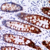 PMPCB / MPP11 Antibody