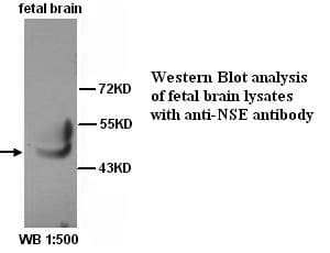 Polyclonal Rabbit anti-Human ENO2 / NSE Antibody (C-Terminus, IHC, WB)