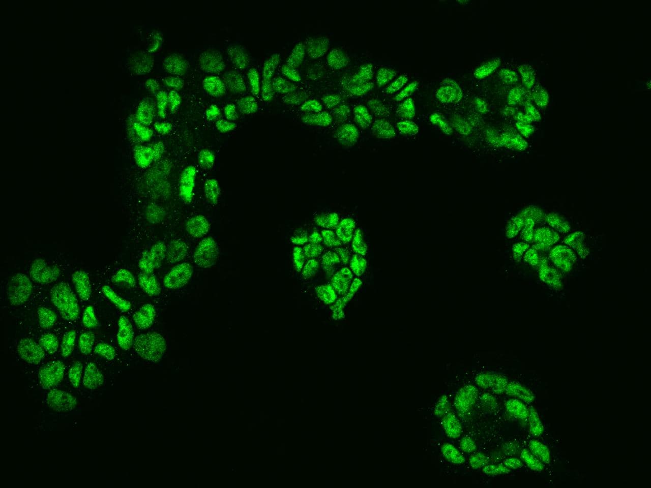 Polyclonal Rabbit anti-Human CTR9 Antibody (IF)