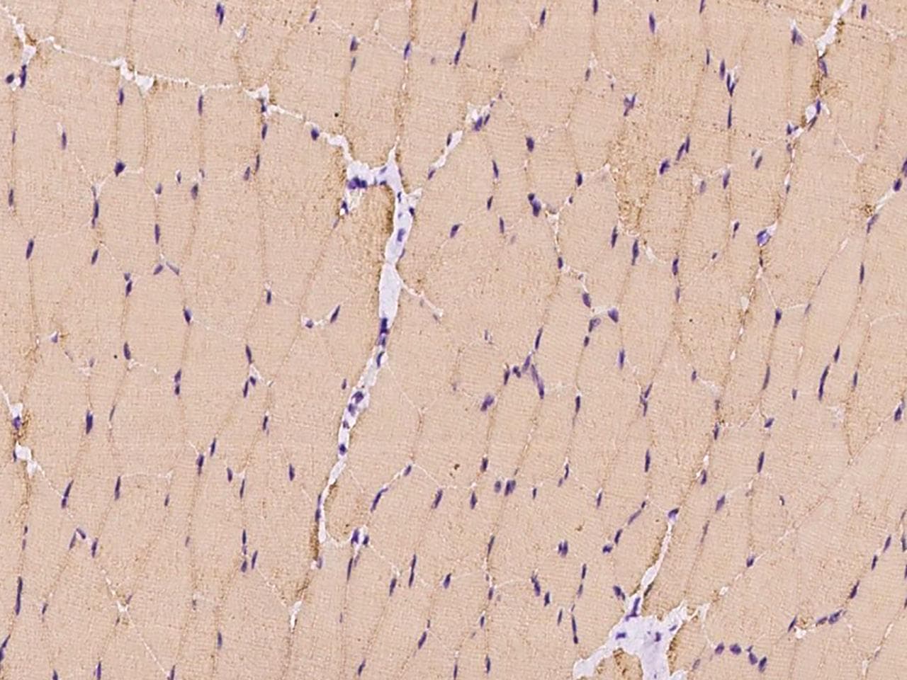 RAF1 / RAF Antibody