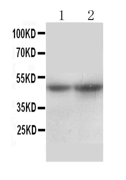 SLC10A1 / NTCP Antibody (aa141-154)